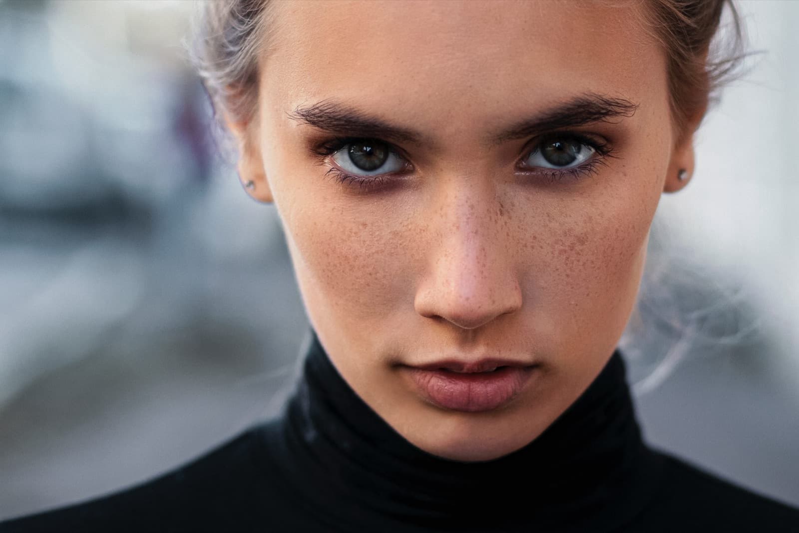 What are the differences between Profhilo and Botox?