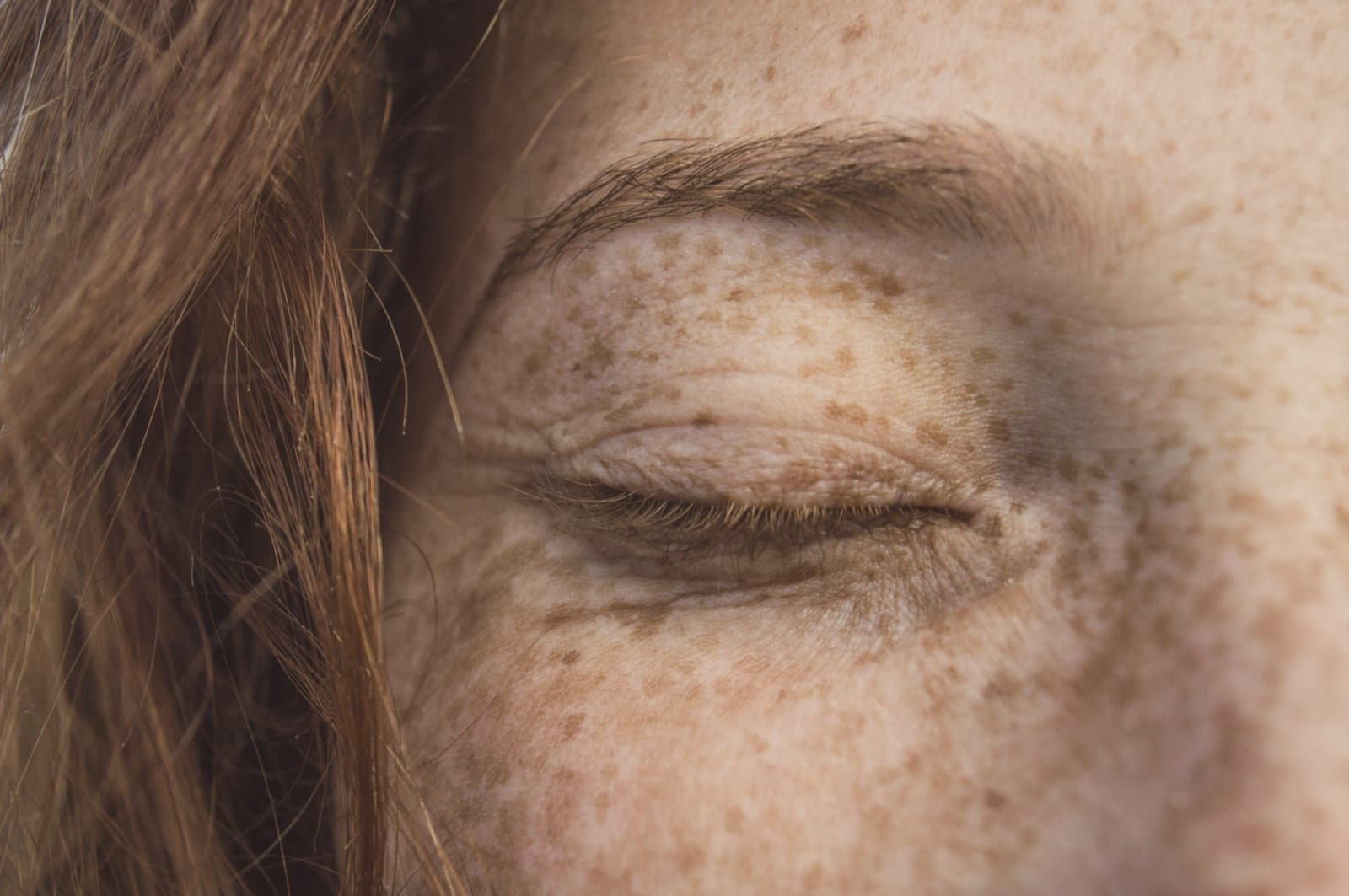 Can botox cause headaches?