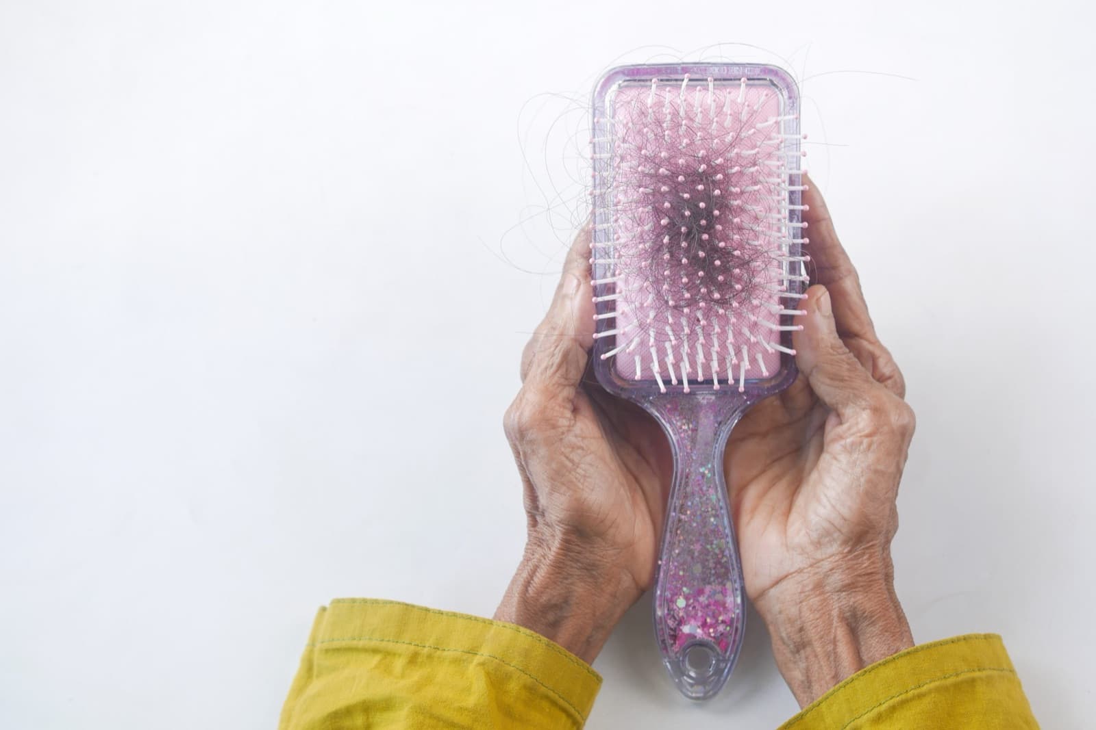 The effectiveness of PRP (Platelet-rich plasma) treatment for hair loss