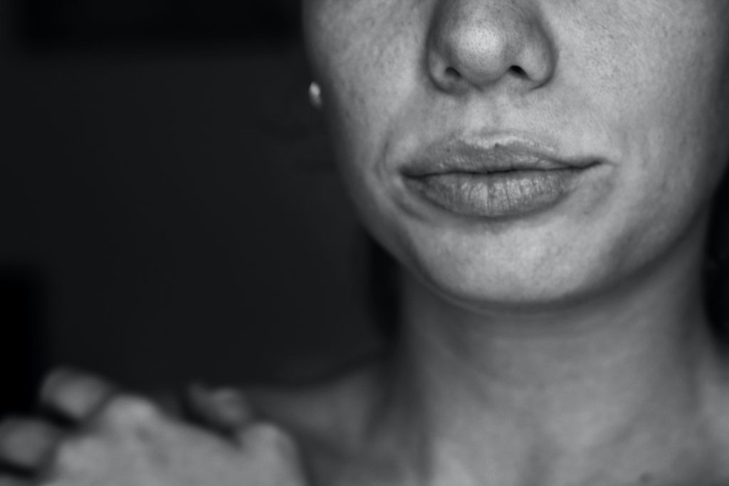 Illustration for the article: Does Botox help TMJ?